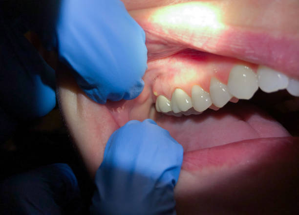 Best Emergency Dentist for Special Needs Patients in Glenrock, WY