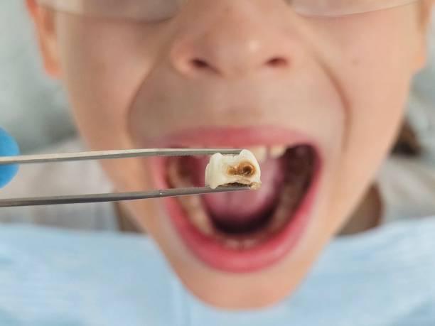 Best Pediatric Emergency Dentist in Glenrock, WY